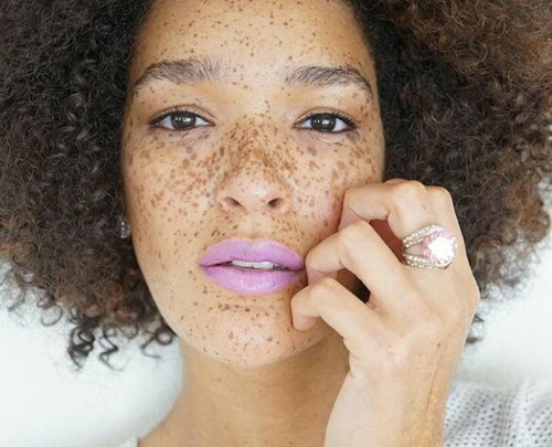 Di-bully karena Wajah Dipenuhi Bintik, Nikia Jadi Model yang Inspiratif Di-bully karena Wajah Dipenuhi Bintik, Nikia Jadi Model yang Inspiratif