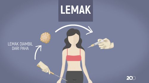 Video: Berapa Ukuran Ideal untuk Payudara? Video: Berapa Ukuran Ideal untuk Payudara?