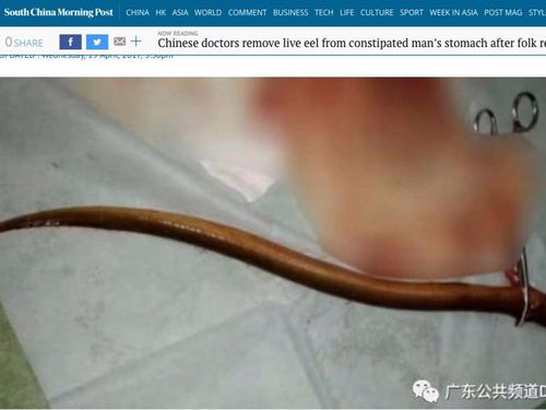 Astaga! Belut Dimasukkan ke Anus untuk Atasi Sembelit Astaga! Belut Dimasukkan ke Anus untuk Atasi Sembelit