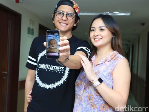 Mengenal Clubfoot, Kondisi yang Dialami Bayinya Joanna Alexandra Mengenal Clubfoot, Kondisi yang Dialami Bayinya Joanna Alexandra