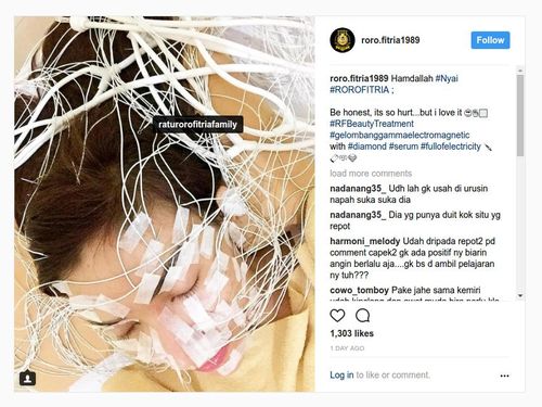 Roro Fitria Perawatan Kulit Wajah dengan Serum Berlian, Apa Dampaknya? Roro Fitria Perawatan Kulit Wajah dengan Serum Berlian, Apa Dampaknya?