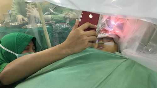 Sering Nyeri di Kepala, Mahasiswi Yogyakarta Ini Ternyata Punya Tumor Sering Nyeri di Kepala, Mahasiswi Yogyakarta Ini Ternyata Punya Tumor