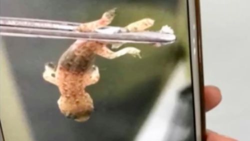 Hii! Ada Cicak Hidup di Dalam Rongga Telinga Pria Ini Hii! Ada Cicak Hidup di Dalam Rongga Telinga Pria Ini