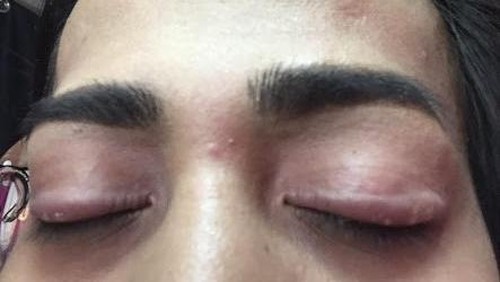 Hati-hati Pakai Kosmetik Palsu Kalau Tak Mau Menderita Seperti Wanita Ini Hati-hati Pakai Kosmetik Palsu Kalau Tak Mau Menderita Seperti Wanita Ini