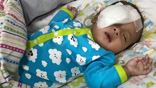 Saran Dokter Spesialis Mata Agar Anak Tak Kena Katarak Saat Bayi Saran Dokter Spesialis Mata Agar Anak Tak Kena Katarak Saat Bayi