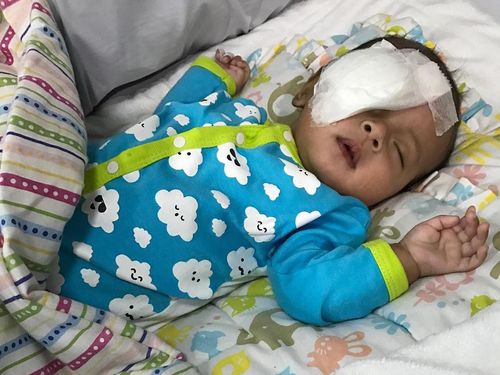 Selain Infeksi Saat Kehamilan, Katarak Seperti Bayi Asri Welas Bisa Disebabkan Hal Ini Selain Infeksi Saat Kehamilan, Katarak Seperti Bayi Asri Welas Bisa Disebabkan Hal Ini