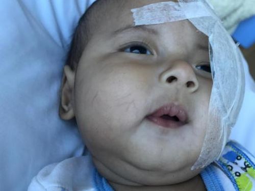 Belum Berusia Satu Tahun Bayi Asri Welas Dioperasi Katarak, Tepatkah? Belum Berusia Satu Tahun Bayi Asri Welas Dioperasi Katarak, Tepatkah?